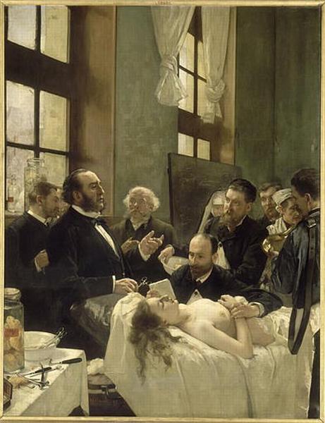 AVANT L'OPERATION OU LE DOCTEUR PEAN OPERANT A L'HOPITAL SAINT-LOUIS, DEMONTRANT SA DECOUVERTE DU PINCEMENT DES VAISSEAUX