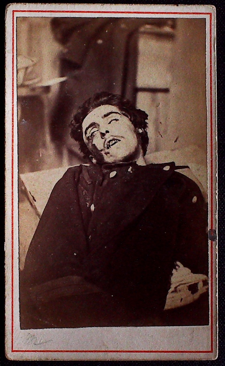Cadavre de Communard, inconnu