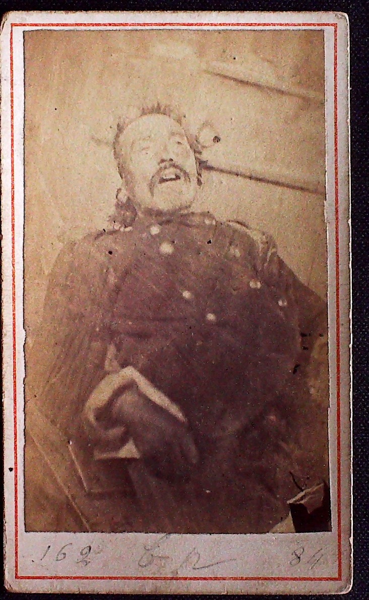 Cadavre de Communard, Ferdinand Louis Péré