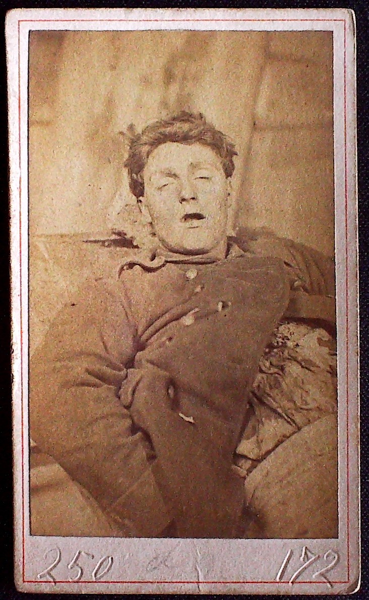 Cadavre de Communard, Louis Deperrois