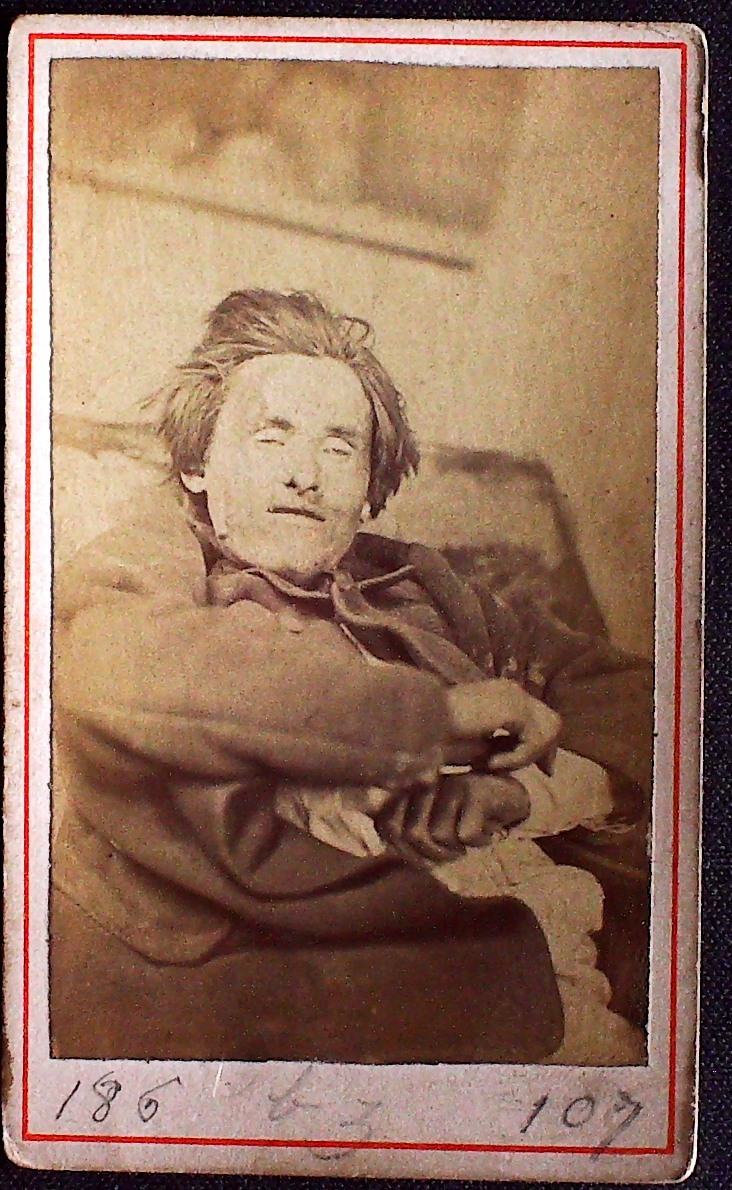 Cadavre de Communard, Corentin Le Bougne