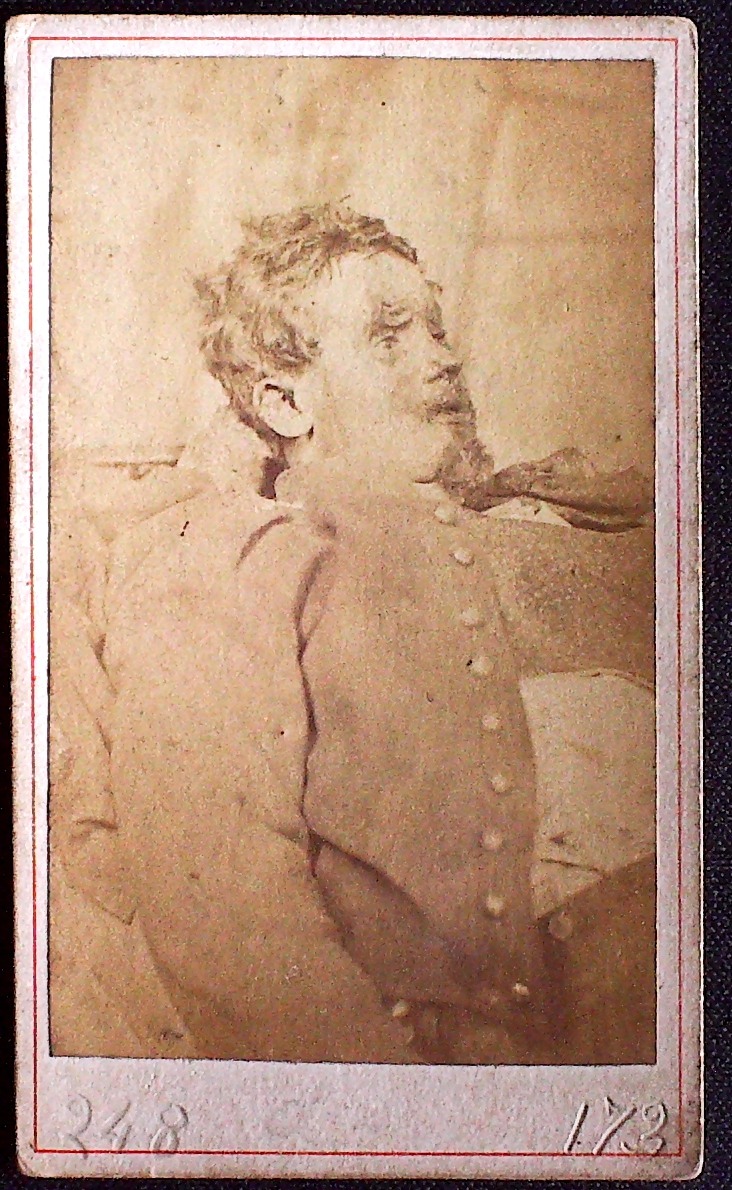 Cadavre de Communard, Jean Bardolle