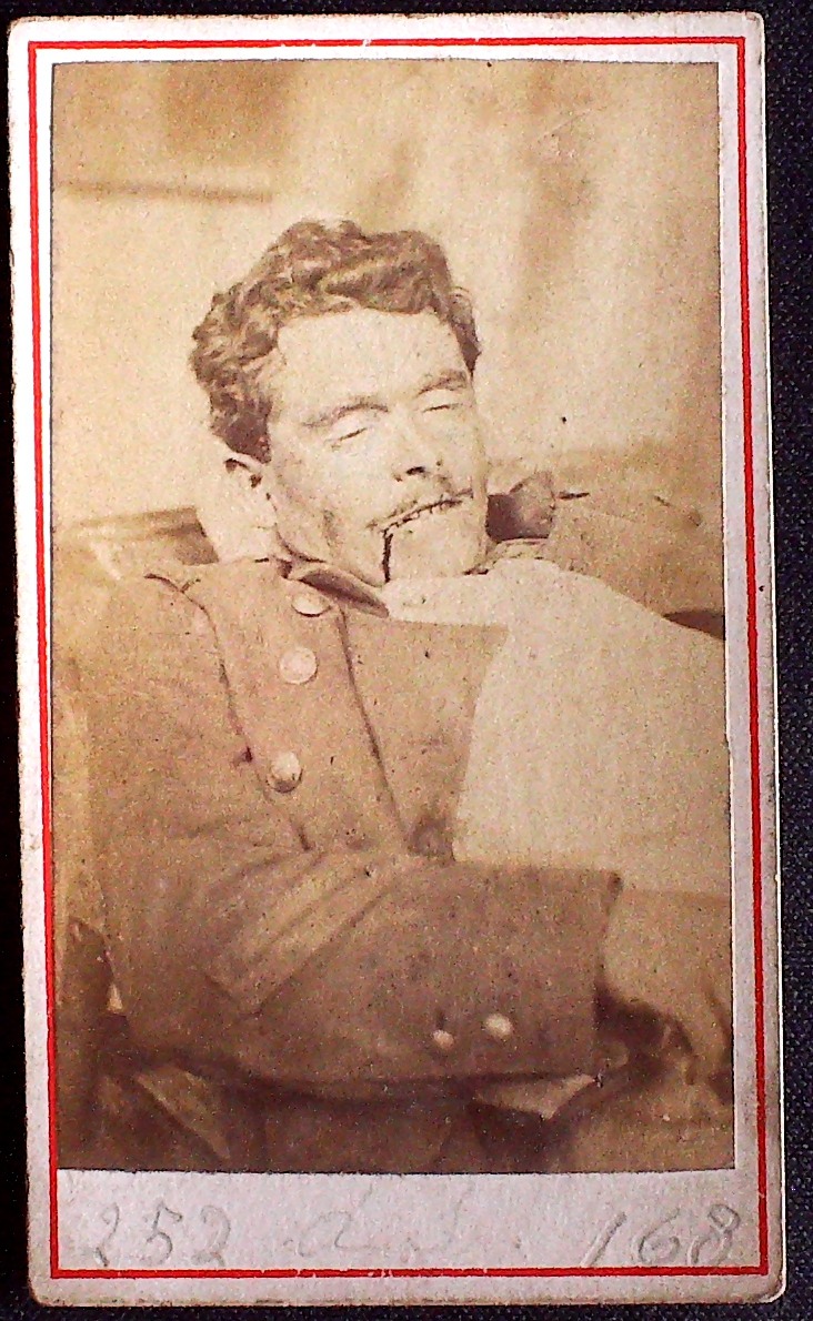 Cadavre de Communard, Louis Cordonnier