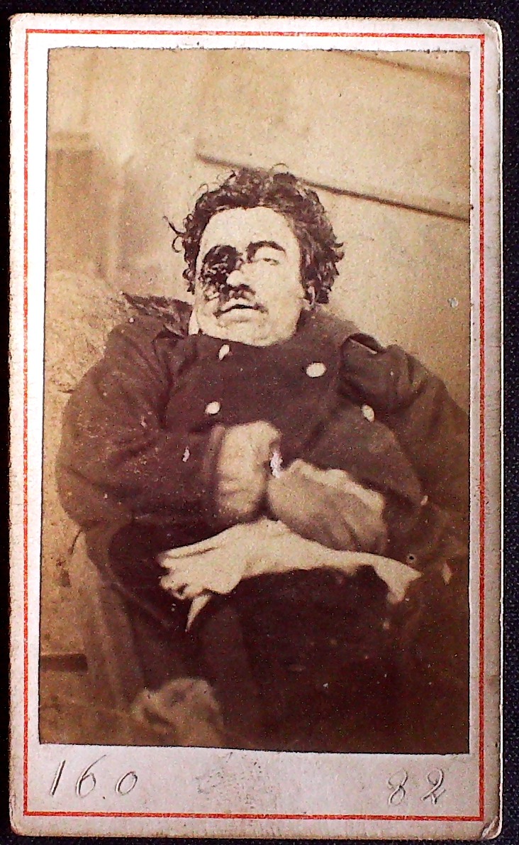 Cadavre de Communard, Rongier