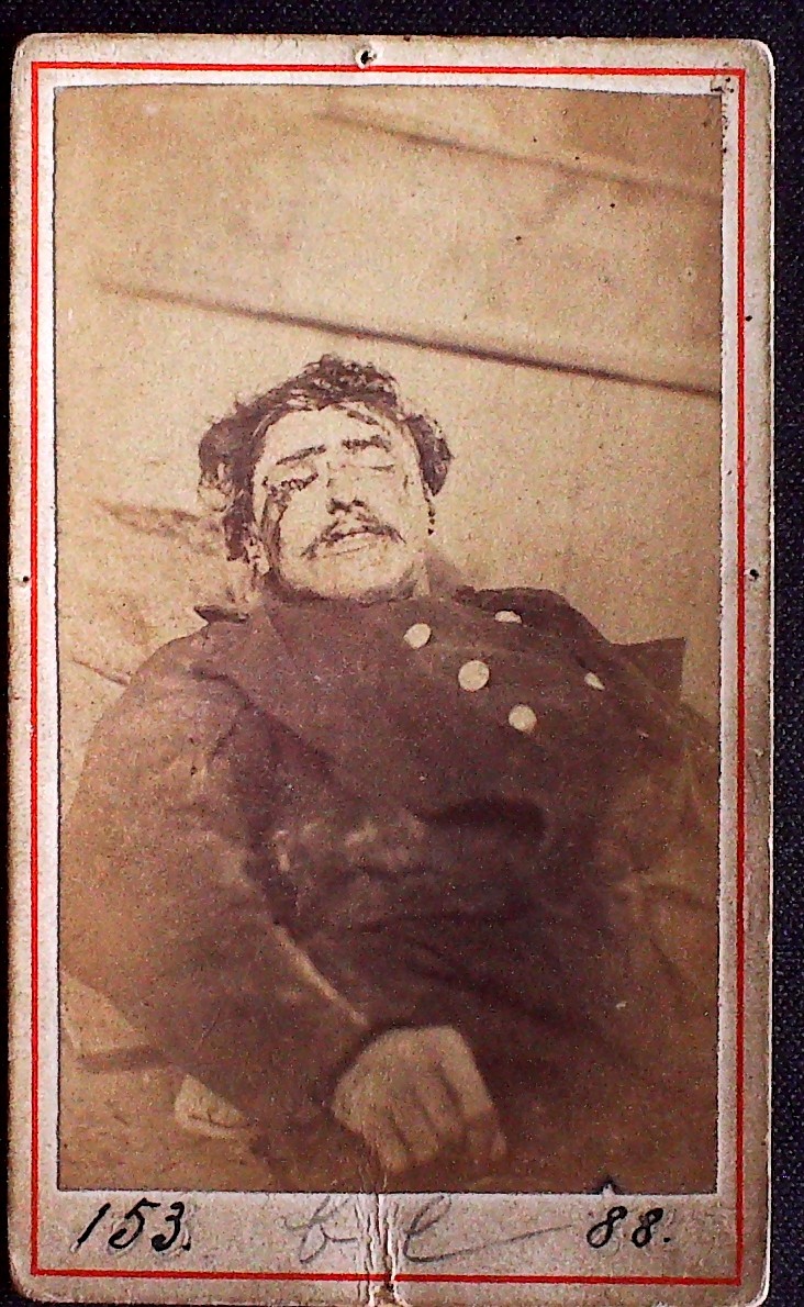 Cadavre de Communard, Louis Perdu