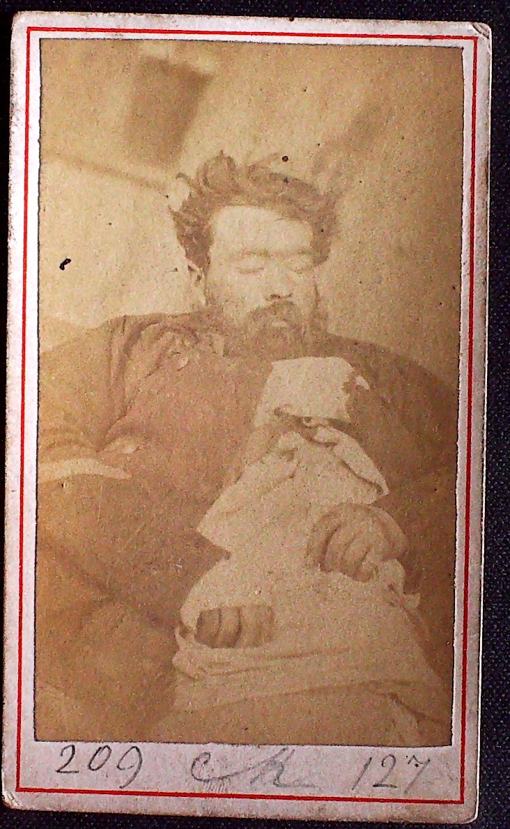 Cadavre de Communard, Etienne Lazarien