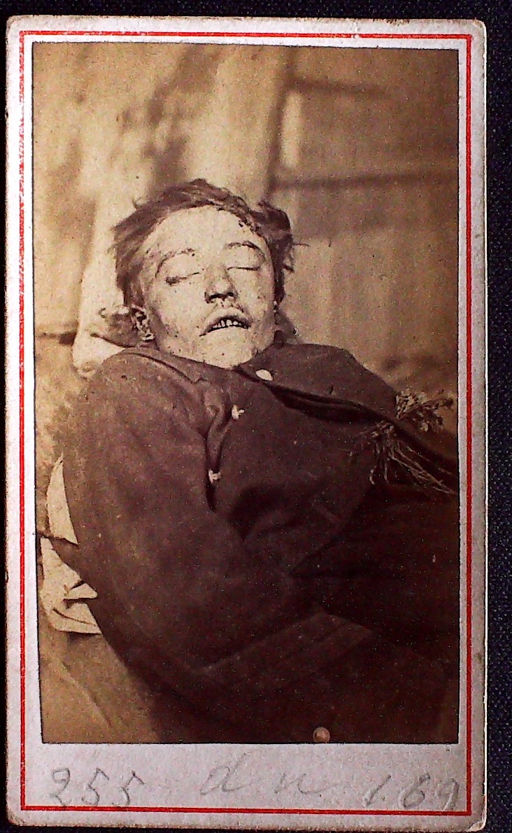 Cadavre de Communard, Bernard Silenhofen