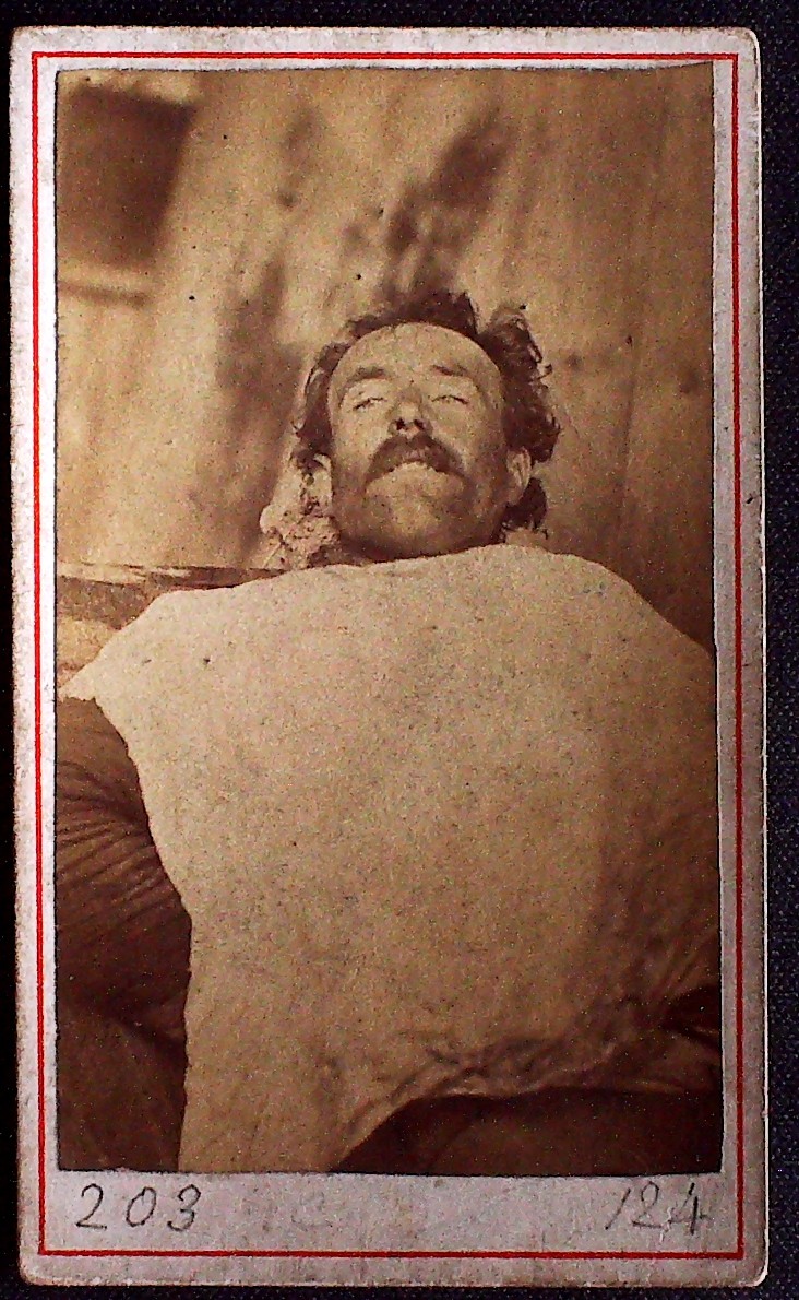 Cadavre de Communard, Cantin