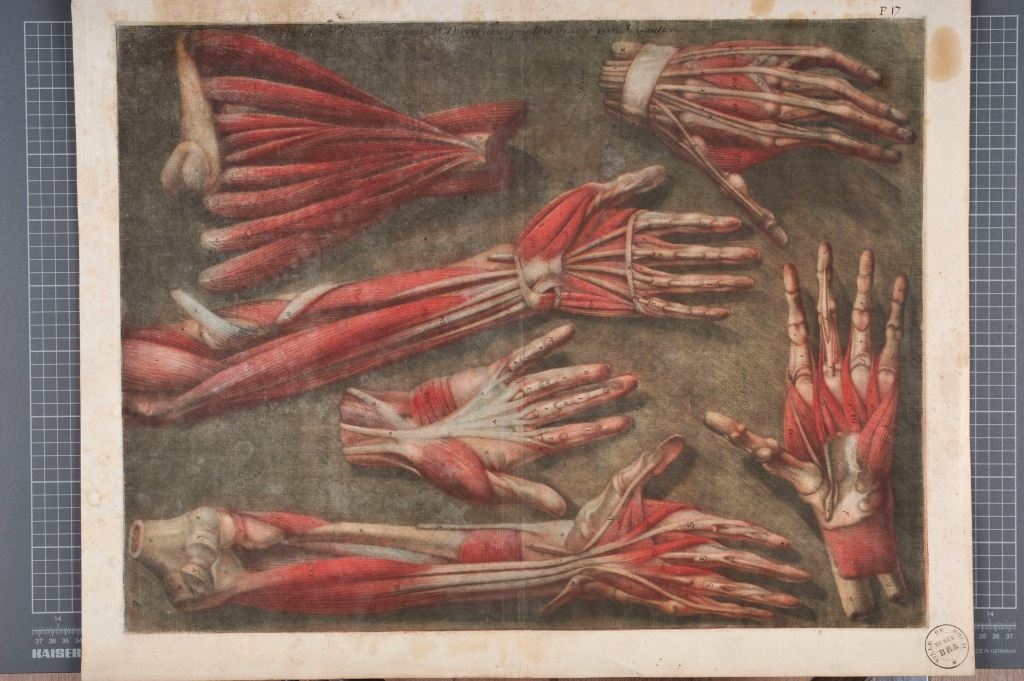"Dix-septième planche. Explication des parties des figures représentées dans cette planche, & des portions des muscles qu'elles contiennent, qui ont été démontrés. [...]"  (Titre)