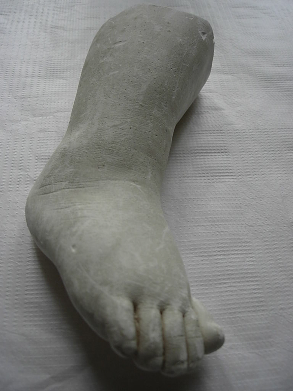 Moulage mortuaire du pied de Nini Clésinger