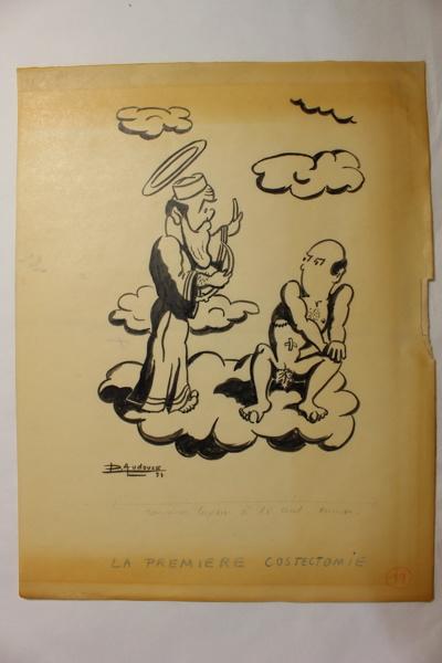 Caricature 'La première costectomie'