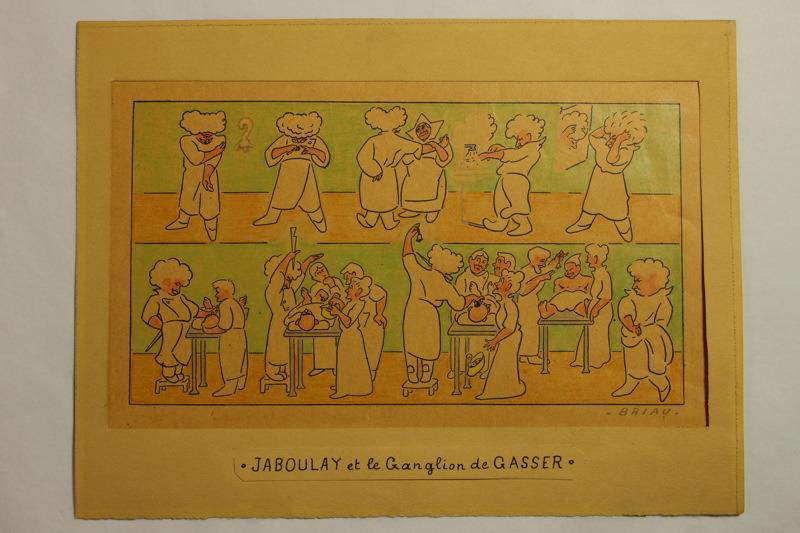 Caricature du professeur Jaboulay et le ganglion de Gasser
