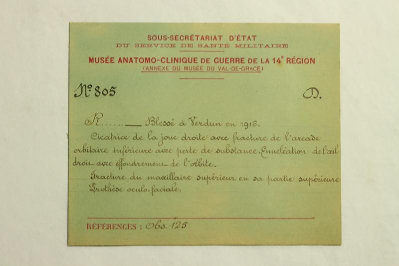 Gueules Cassées (titre factice)