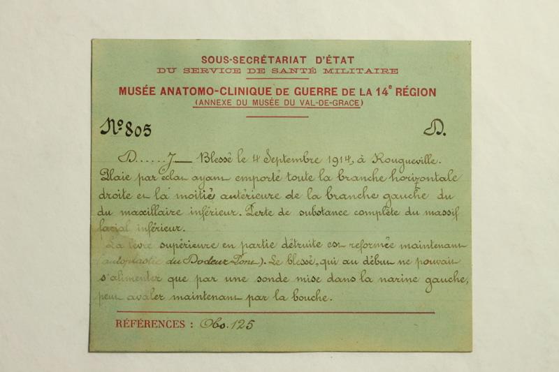 Gueules Cassées (titre factice)