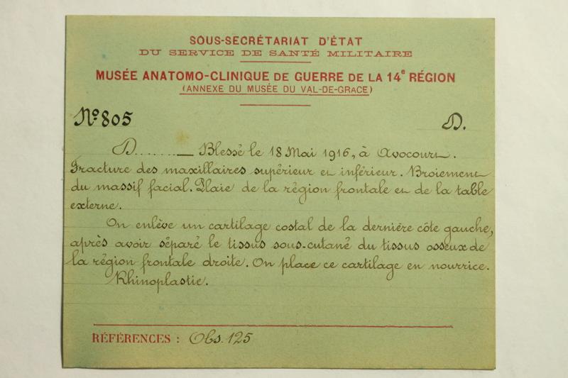 Gueules Cassées (titre factice)