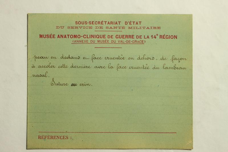 Gueules Cassées (titre factice)