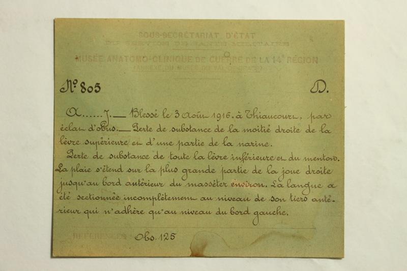 Gueules Cassées (titre factice)