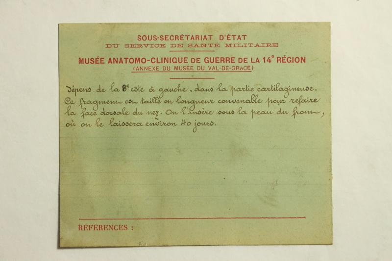 Gueules Cassées (titre factice)