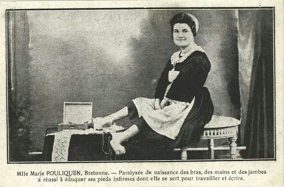 Mlle Marie POULIQUEN Bretonne - Paralysée de naissance des bras des mains et des jambes a réussi à éduquer ses pieds infirmes dont elle se sert pour travailler et écrire.