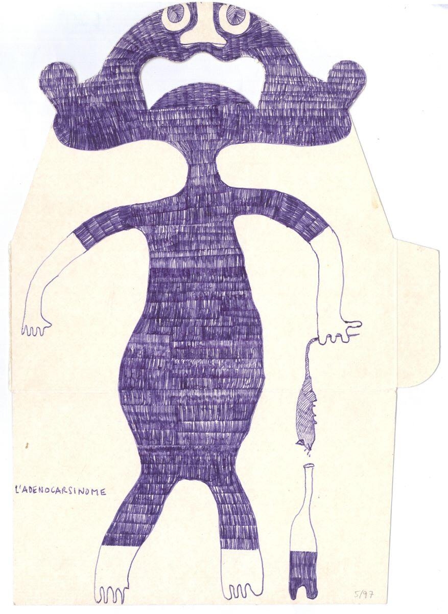 L'ADENOCARSINOME