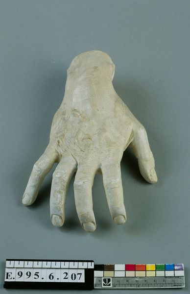 Moulage de la main droite d'Isidore Philipp (1863-1958)