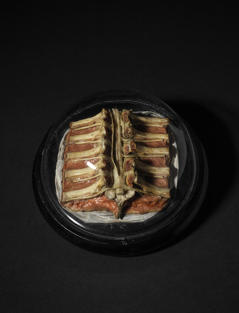 Fragment de colonne vertébrale ouverte