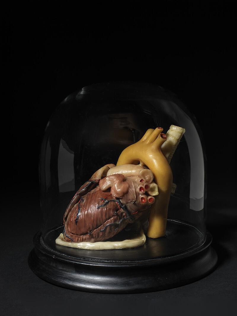 Cœur et gros vaisseaux