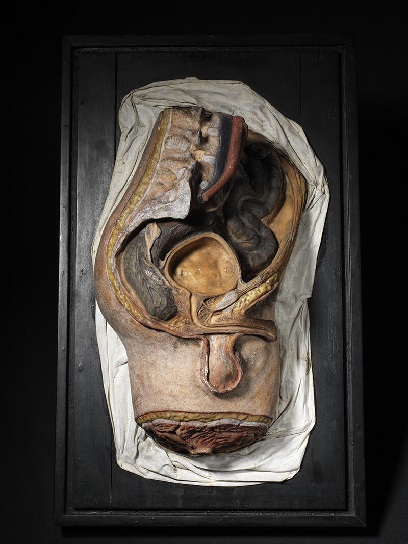 Organes génitaux urinaires, bassin d'homme