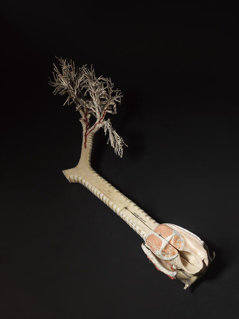 Larynx - Trachée - Bronches