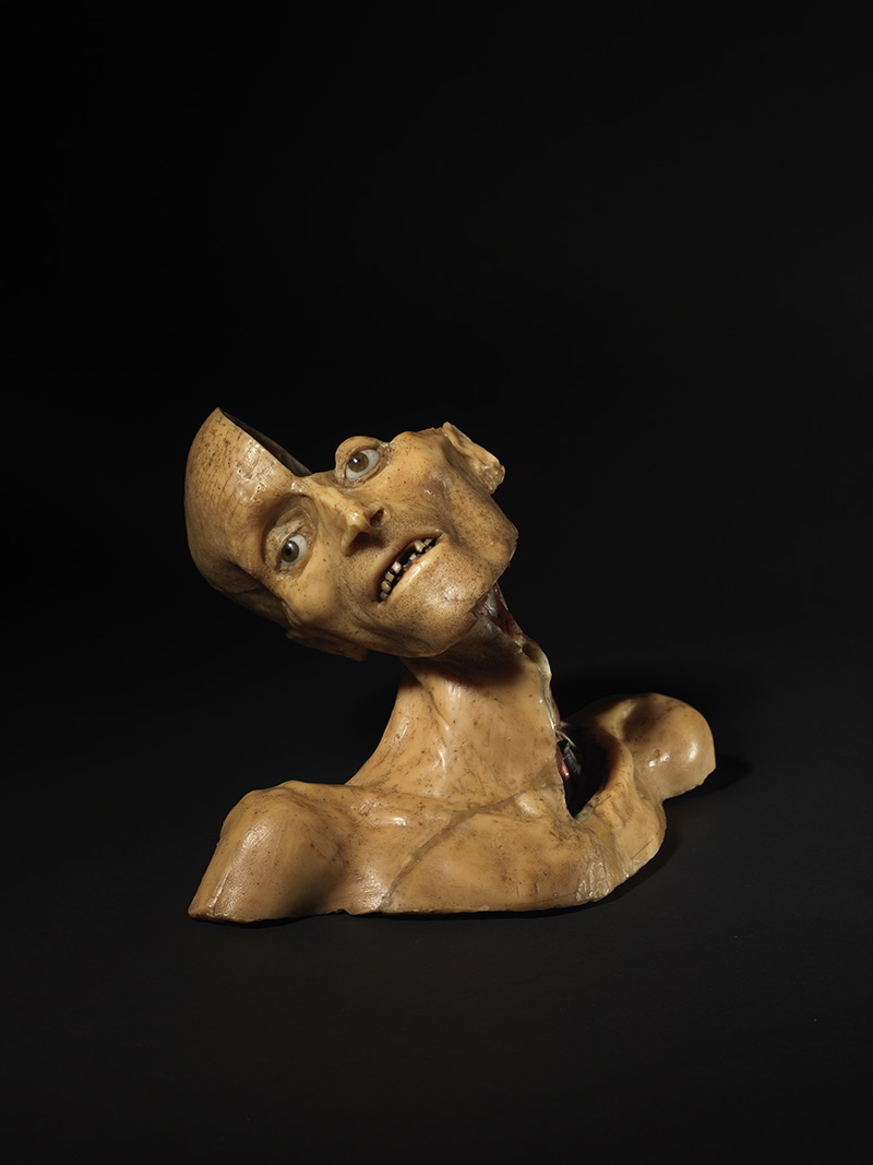 Nerfs de la région cervicale et circulation intracrânienne