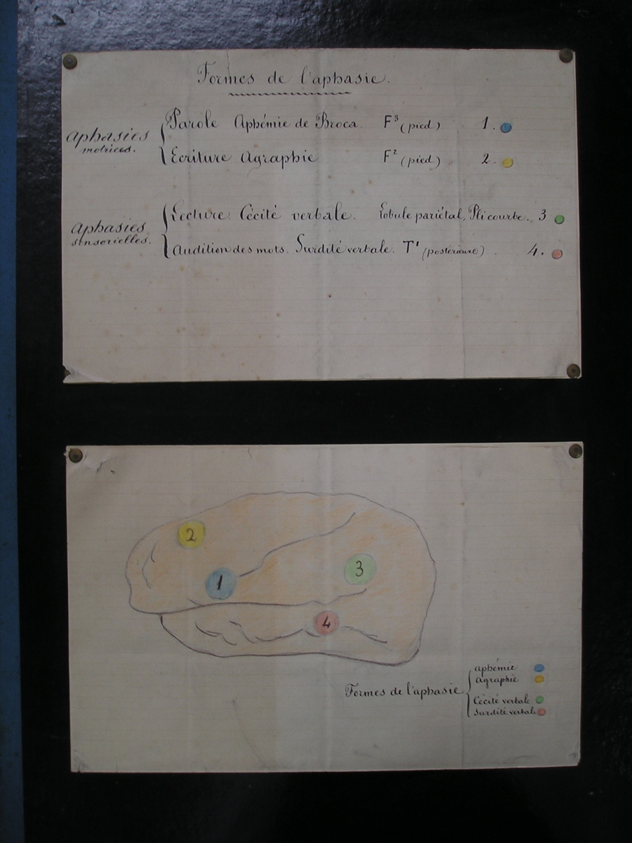 Formes de l'aphasie : aphasies motrices, aphasies sensorielles [en 8 schémas et textes]