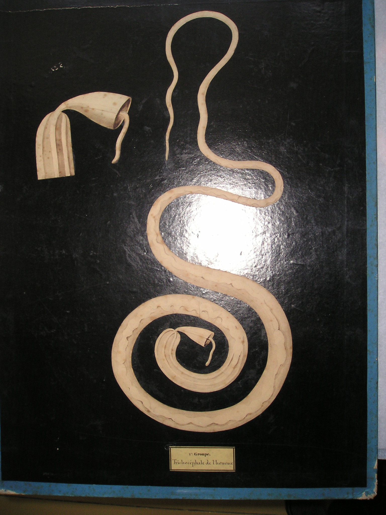 Trichocéphale de l'homme