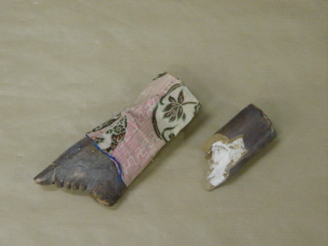 Pied bandé de femme chinoise (fac-similé)